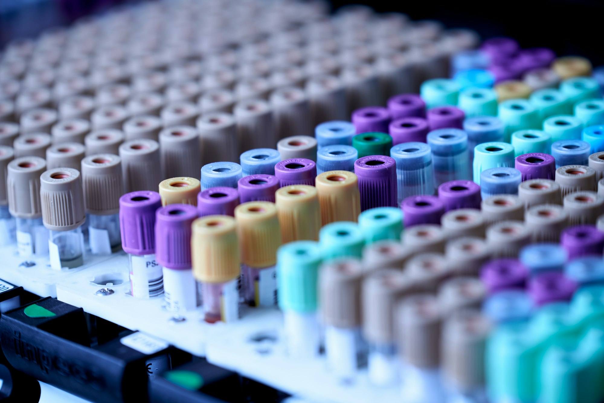 Rows of sample tubes in a laboratory rack